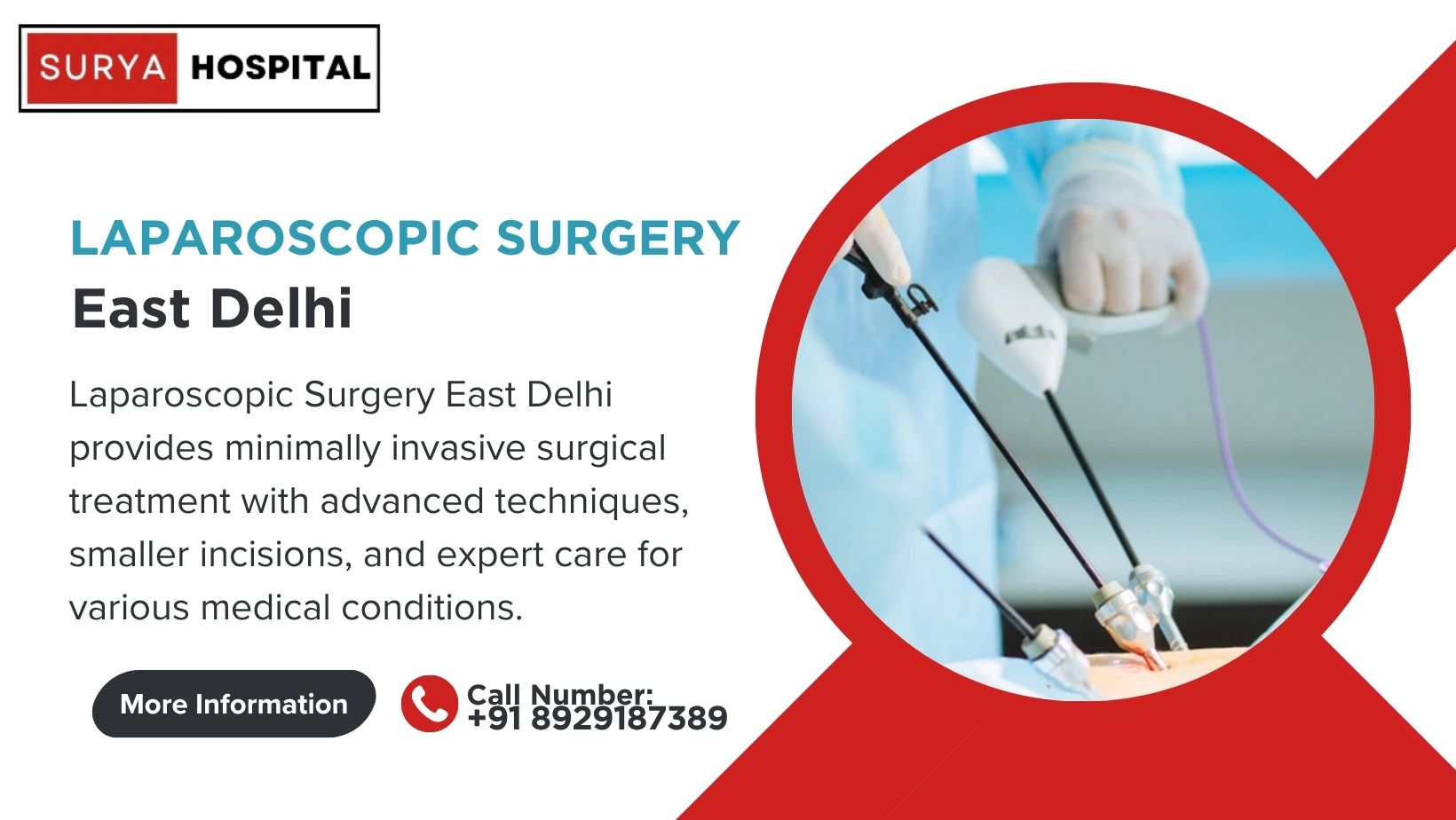 Laparoscopic Surgery East Delhi For Quality Medical Care